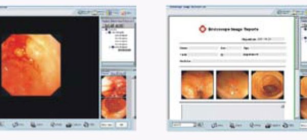 P6310 Endoscope